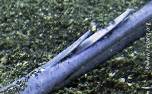 stingray barb